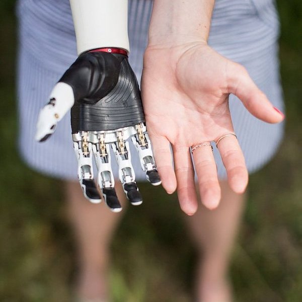 робот,медицина,организм человека, Кибер-протезы и медицина будущего